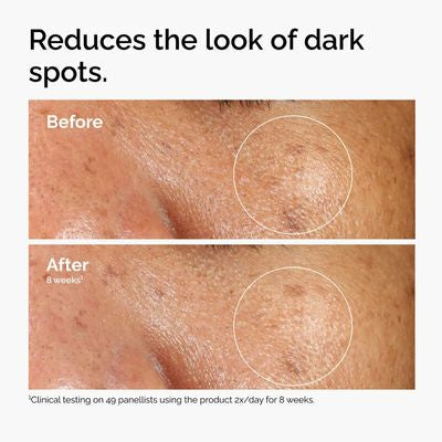 The Ordinary Alpha Arbutin 2 % + Ha 30 ml