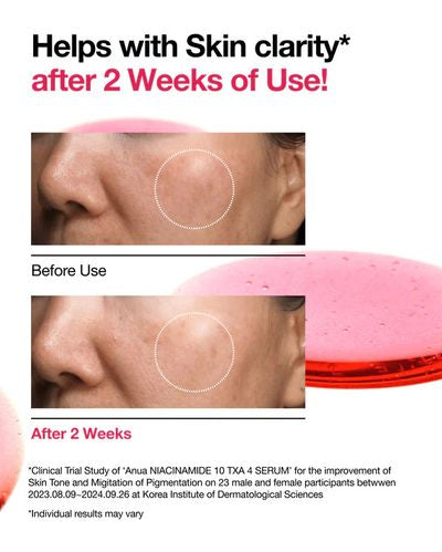 Anua Niacinamide 10% + TXA 4% Serum – 30ml