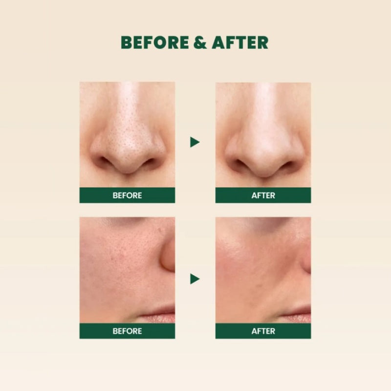 K-SECRET SEOUL 1988 Cleansing Foam: Pine Cica 1% + Probiotics (150ml)